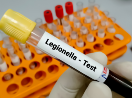Brote de legionela en el Upper East Side deja 23 contagios y activa inspecciones en Nueva York