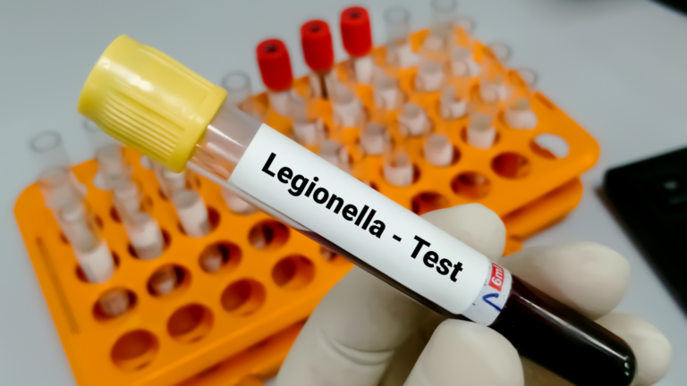 Legionelosis en Upper East Side deja 11 muertos y 94 personas afectadas